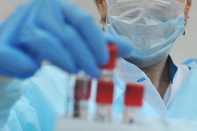 Врачи выявили 36 новых случаев заражения коронавирусом за сутки, выздоровели 2, умер 1