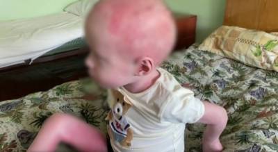 Раскаленной сковородкой по голове: избитый матерью малыш из Рыбинска оказался фейком