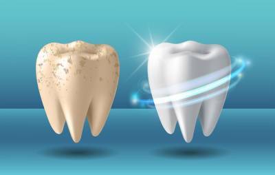 Что происходит с зубами во время отбеливания, и насколько это безопасно: ответ стоматолога