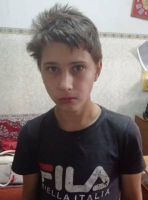 В Кузбассе без вести пропал 15-летний подросток со шрамом