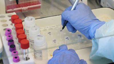 В Удмуртии за сутки выявили 60 случаев коронавируса
