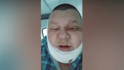 Пьяный таксист вонзили нож в шею коллеге во время поездки