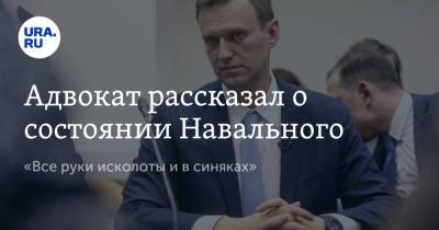 Адвокат рассказал о состоянии Навального. «Все руки исколоты и в синяках»