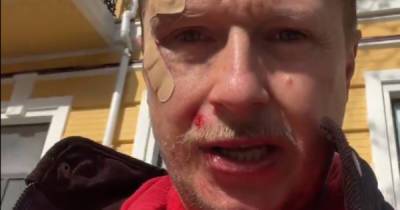 В Киеве напали на телеведущего Майкла Щура