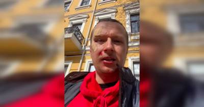 В центре Киева избили телеведущего Майкла Щура (видео)