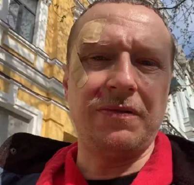 В Киеве избили ведущего "Телебачення Торонто" Майкла Щура