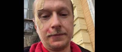 Пешеходы против самокатов: в Киеве напали на телеведущего Майкла Щура