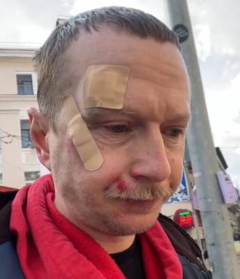У Києві побили відомого журналіста з Прикарпаття Майкла Щура