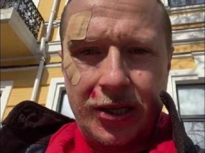 Избиение Майкла Щура: Геращенко сбросил видео, которое журналист сам предоставил полиции