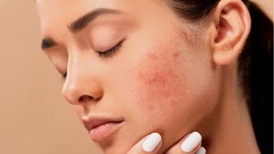 Перенесшие COVID-19 люди могут иметь хронические проблемы с кожей