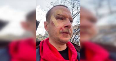 Избиение Майкла Щура в Киеве: ведущий отказался от экспертизы и признал свою неправоту