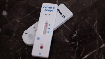 Вакцинировавшимся от COVID-19 россиянам объяснили необходимость сдачи ПЦР-теста