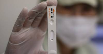 В Южной Корее одобрили первые комплекты для самостоятельного тестирования на коронавирус