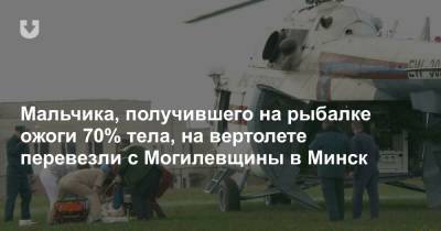 Мальчика, получившего на рыбалке ожоги 70% тела, на вертолете перевезли с Могилевщины в Минск