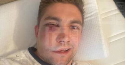 Фото избитого актером Палем хоккеиста