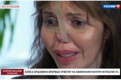 Экс-жена Аршавина пришла на телешоу и впервые показала обезображенное лицо