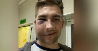 "Били с ноги или коленом": боксер оценил травмы избитого хоккеиста
