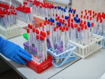 Исследование: иммунитет к коронавирусу в начале лета будет у 70% петербуржцев