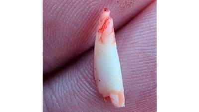 Акула сломала зуб об голову мужчины: он ловил рыбу под водой - фото, видео 18+
