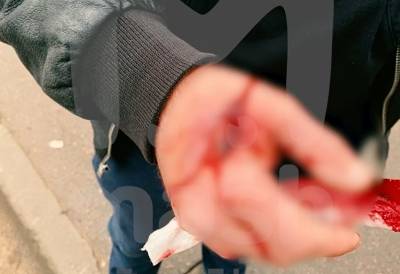 Видео: водитель прострелил пешеходу руку в Петербурге