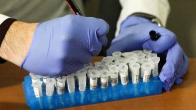 Медики выявили 9284 новых случая заражения коронавирусом в России за сутки