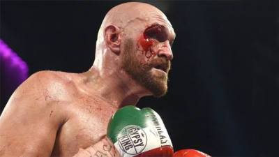 Битва чемпионов-тяжеловесов: боксер Фьюри бросил вызов бойцу Нганну