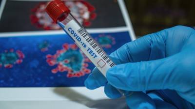Тесты для выявления антител после вакцинации "ЭпиВакКороной" поступили в регионы России