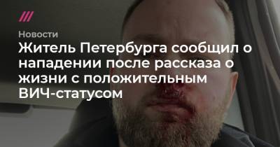 Житель Петербурга сообщил о нападении после рассказа о жизни с положительным ВИЧ-статусом
