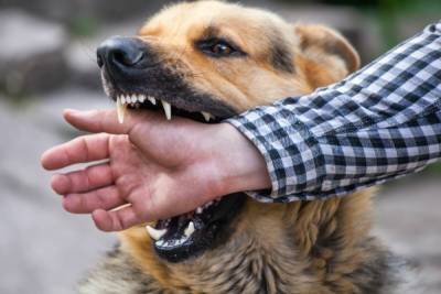 Костромским чиновникам придется отдуваться за кусачих собак