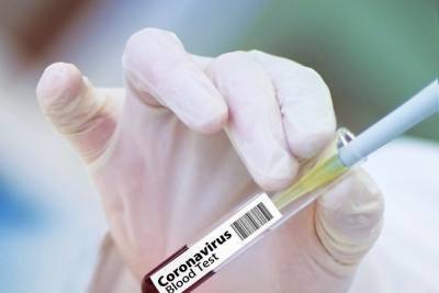 В ЛНР снова растет количество зараженных коронавирусом