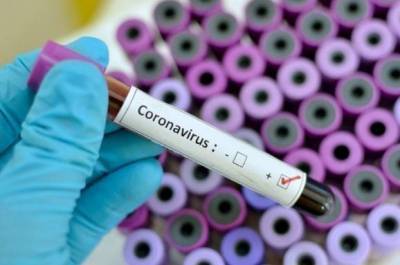 На Луганщине лабораторно подтверждено 56 новых случаев COVID-19