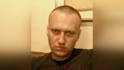 Заключенного Навального перевели в медсанчасть