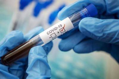 Число умерших от коронавируса в Чувашии достигло 1257