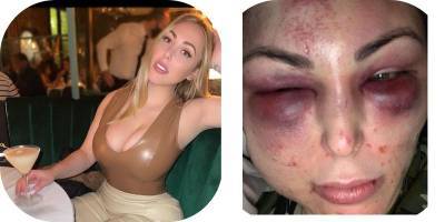 Кристен Эванджелин - девушка обвинила баскетболиста Дариуса Морриса в домашнем насилии - фото, видео - ТЕЛЕГРАФ