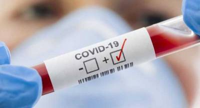 Украина заняла первое место в Европе по новым случаям заболевания COVID-19 и третье место по смертям, - Worldometers