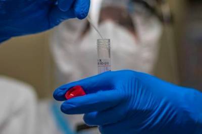 В Чувашии список жертв коронавируса пополнили еще шесть человек