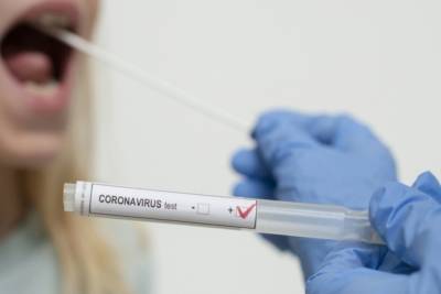 В Мурманской области снижается уровень заболеваемости коронавирусом
