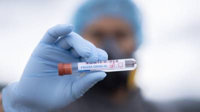 Медики выявили 8465 новых случаев заболевания коронавирусом в России за сутки