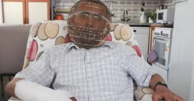 Бросающий курить житель Турции заковал свою голову в клетку
