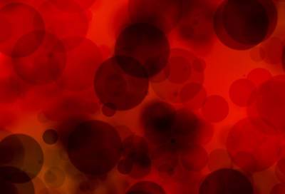 Гематолог назвала неочевидный способ выявить рак крови