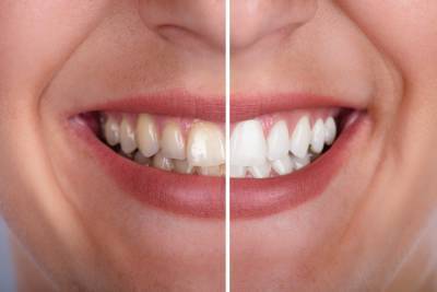 8 фактов о зубах, которые вы должны знать