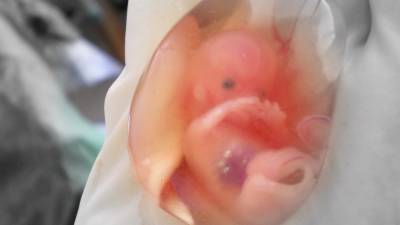 РПЦ предложили законодательно закрепить усыновление замороженных эмбрионов