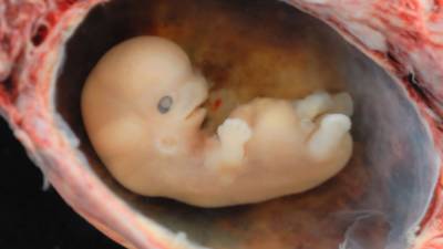 РПЦ предложила россиянкам усыновлять замороженных эмбрионов