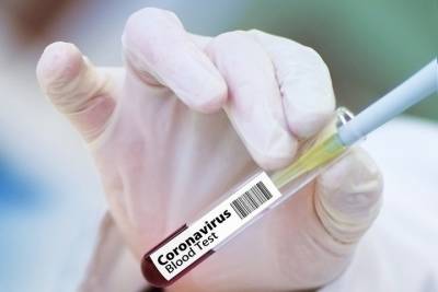 Еще 34 человека заболели коронавирусом в Татарстане