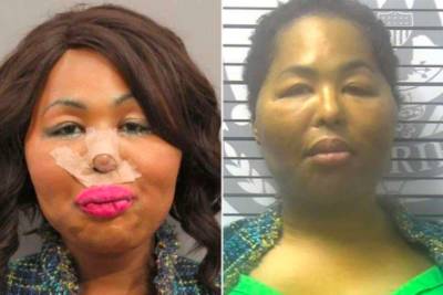 Американка-трансгендер ограбила банк, чтобы накачать губы
