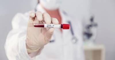 В Украине за сутки выявили более 3,6 тысяч новых зараженных коронавирусной инфекцией