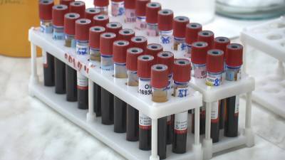 В Беларуси приступили к заготовке плазмы крови доноров, привитых от коронавируса