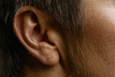 Невролог рассказал, симптомом каких заболеваний является звон в ушах