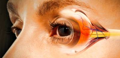 Эксимер: Причины и особенности возникновения глаукомы