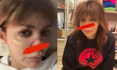 Экс-жена Аршавина сможет восстановить нос, когда заживут язвы на ногах